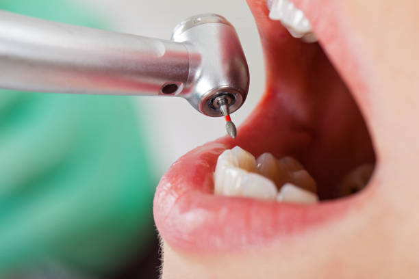 Best Weekend Emergency Dentist in Greenbriar, VA